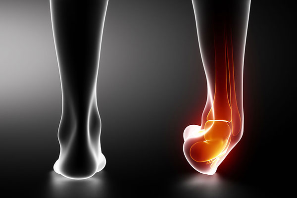 Types of Ankle Sprains - Heiden Orthopedics