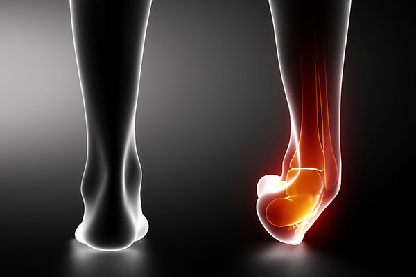 Recover Faster From an Ankle Sprain at Physical Therapy