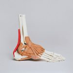 Achilles Tendon Tears: How do you know if your achilles is torn?