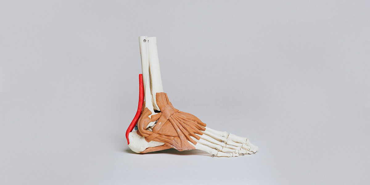 Felt pop in achilles on sale tendon