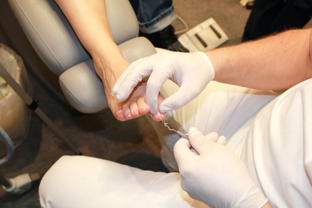 Identifying When Your Ingrown Toenail Requires Medical Attention - Century  Medical & Dental Center