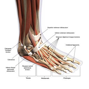 Treating Ankle Tendonitis - Heiden Orthopedics