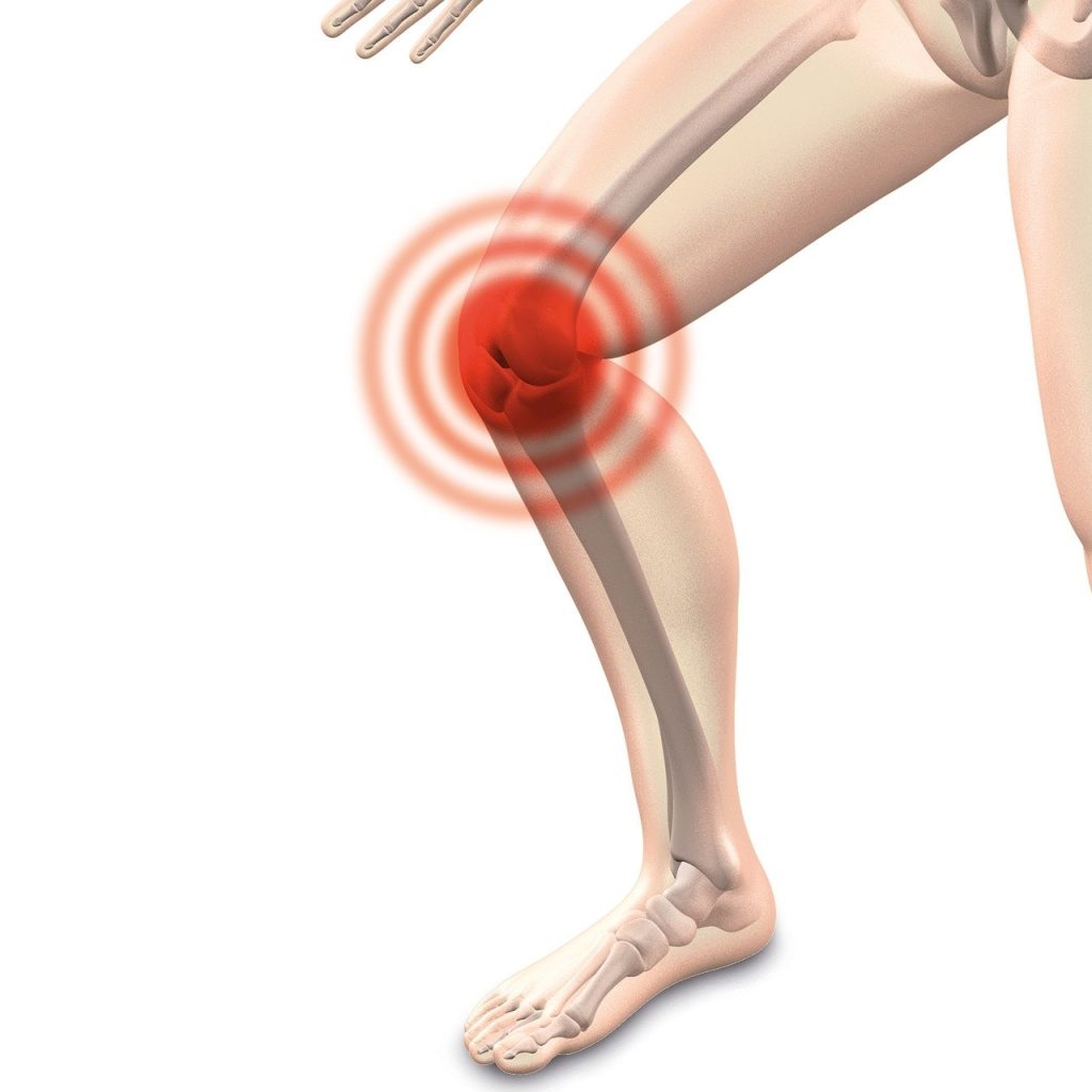 knee instability