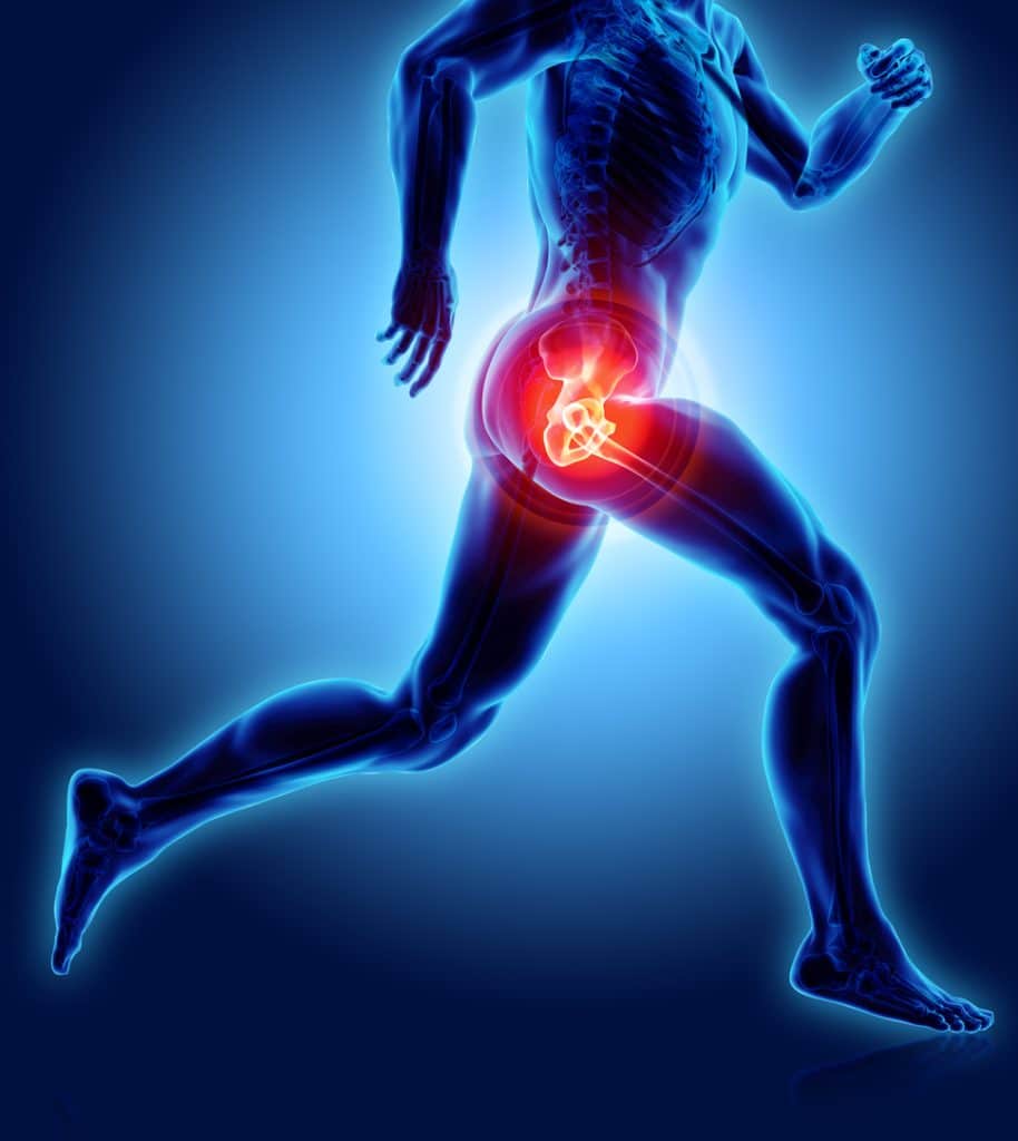 Ask Dr. Gibbs: Do I have hip impingement? - Heiden Orthopedics