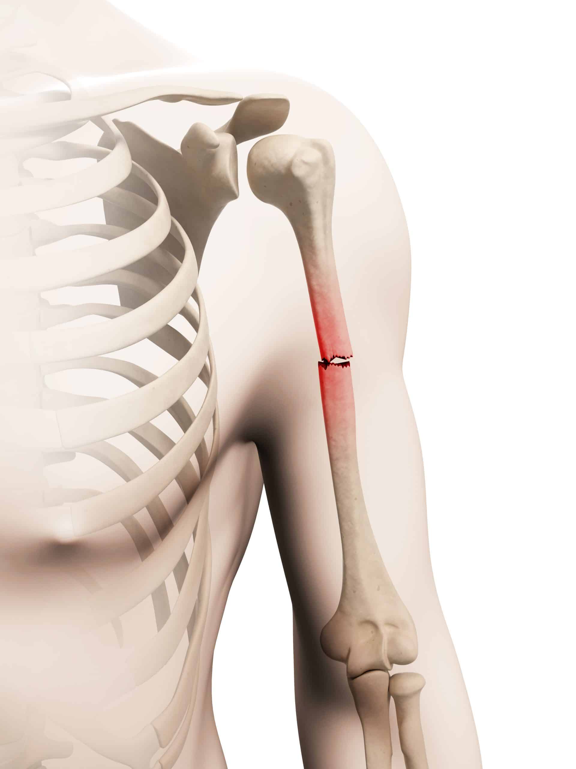 Humerus, Upper Arm, Shoulder Joint, & Arm Bone
