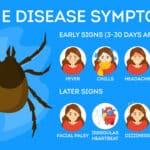 An illustration showing the early and later symptoms of Lyme disease