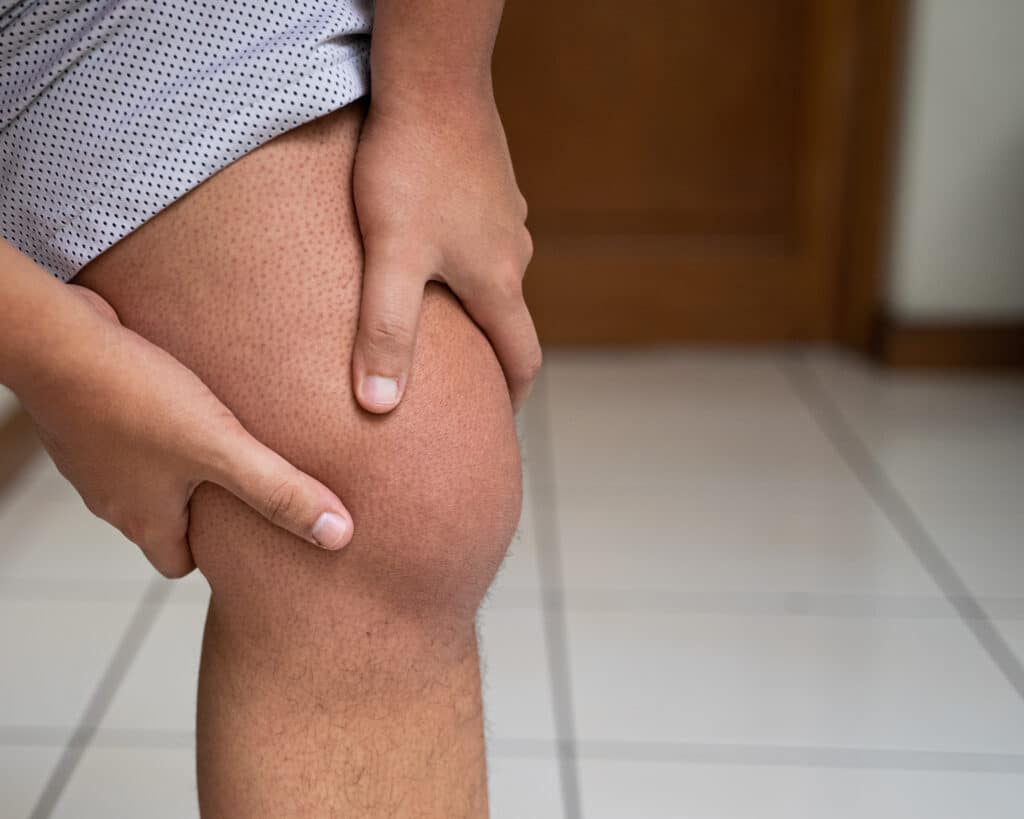 A person touching their knee, which is painful and swollen from Lyme arthritis
