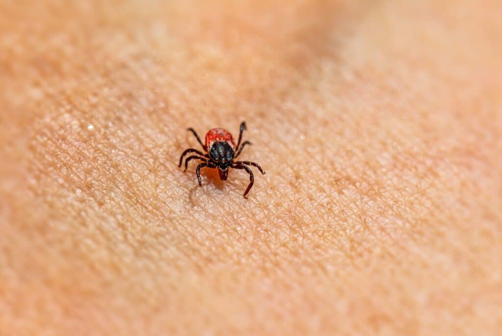 A close-up of a deer tick carrying the bacteria that causes Lyme disease walking across a person's skin
