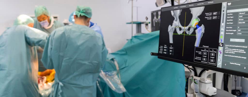Team of orthopedic hip surgeons performing a total hip arthroplasty replacement surgery in an osteoarthritis patient inside the operating room aided by the latest in computer technology.