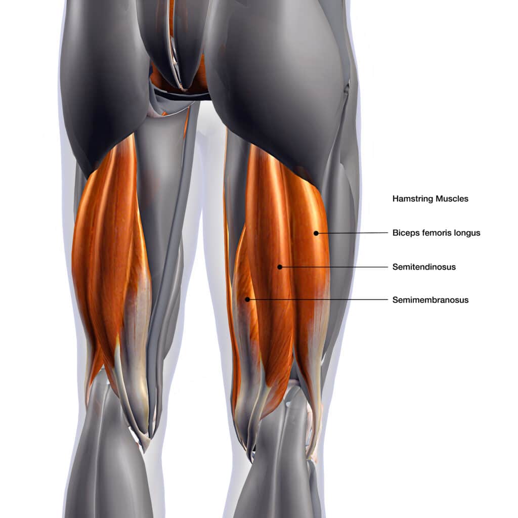 The three muscles of the hamstring, which are healthy and do not show signs of a hamstring strain.