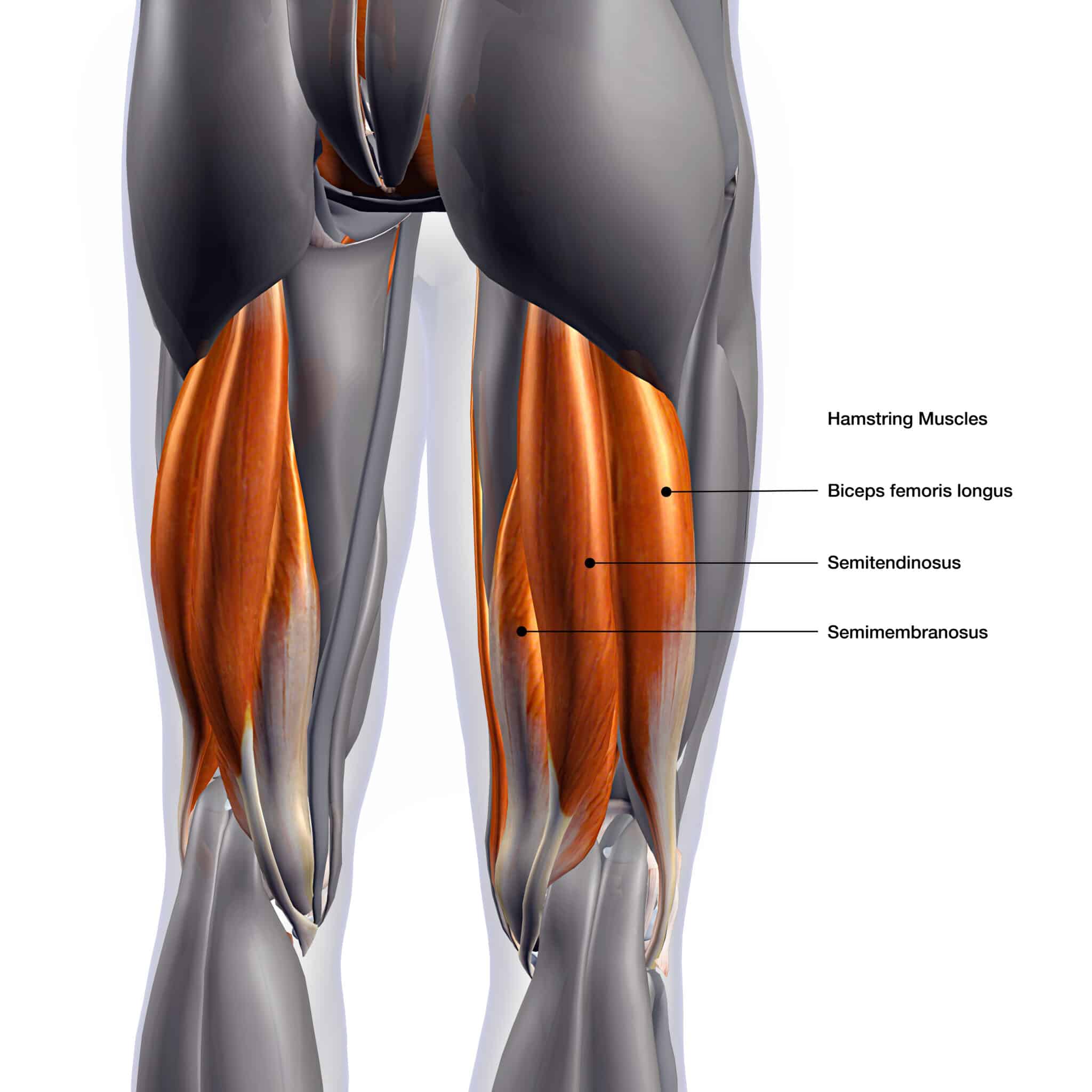 How To Heal A Hamstring Strain Fast Heiden Orthopedics