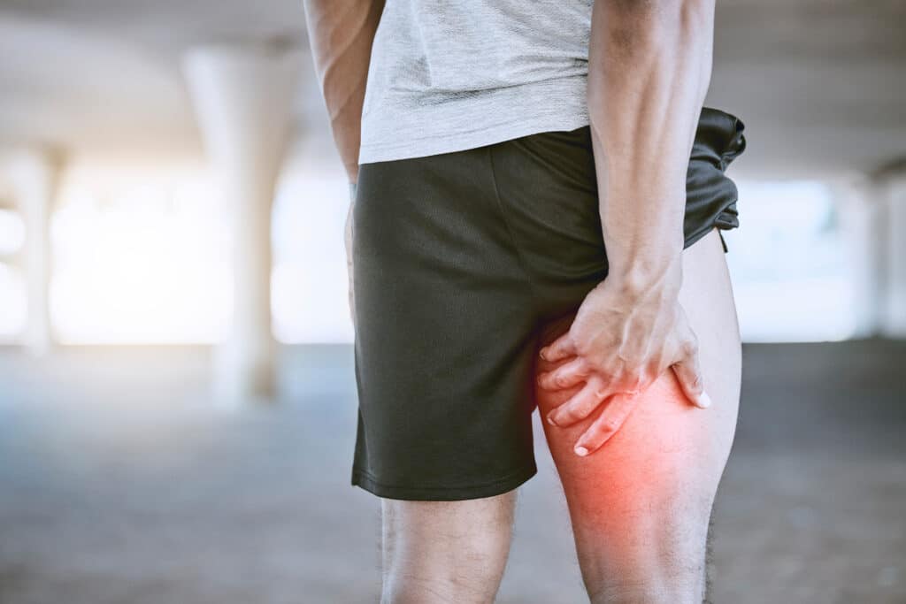 A person holding their hamstring, which is red with pain due to a hamstring strain.