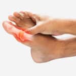 The joint at the base of the big toe, the metatarsophalangeal (MTP) joint, red and sore from hallux rigidus.