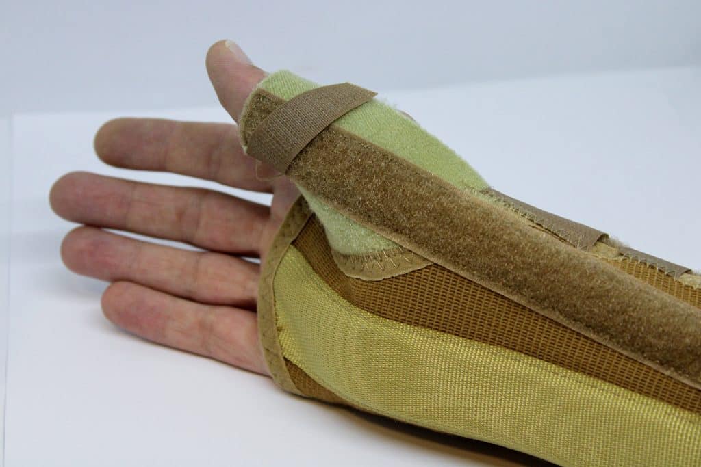 Right hand in a splint following a scaphoid fracture.
